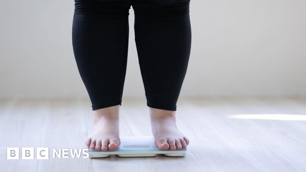 More than 50% of adults predicted to be obese by 2050 worldwide