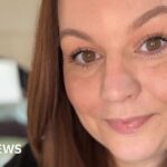 Doctor Tony Dixon faces claims over artificial mesh records