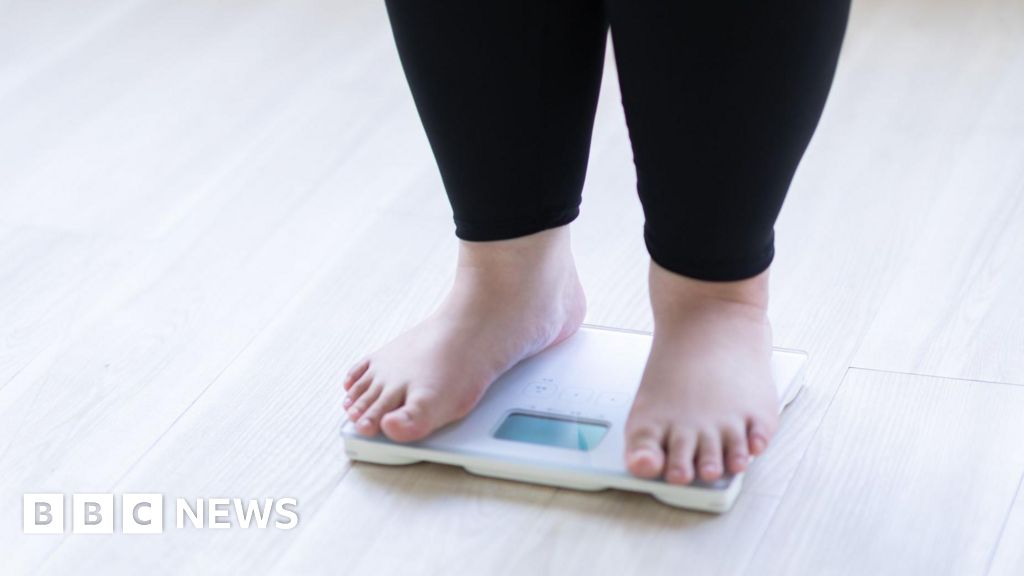 Some children at obesity clinics have BMI of 50