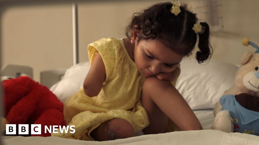 BBC joins injured Gazan children as they arrive in Jordan