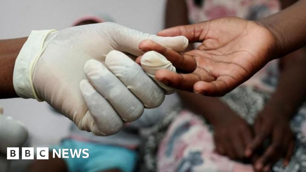 South Africa’s HIV/Aids patients worry about treatment
