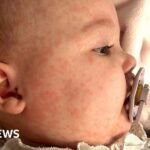 Baby dies of whooping cough after mother not vaccinated while pregnant