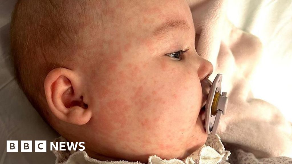 County Durham mother’s vaccination plea after ‘terrifying’ measles
