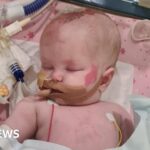 Human skin DNA fertilised to make embryo for first time