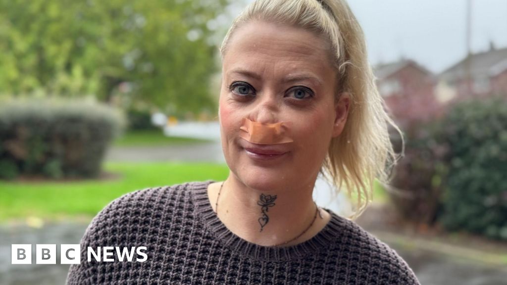 Turkey dental work leaves Telford woman in constant pain
