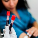 Ford Recalls Nearly 625,000 Vehicles Over Camera Display, Seatbelt Issues