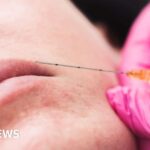 Kiwis and mineral water can cut constipation, says new guidance