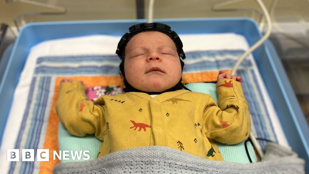 Cambridge ‘swimming cap’ brings hope for brain-injured babies