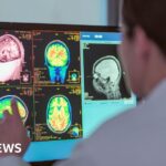 Slight improvement in water quality at bathing sites, new figures show