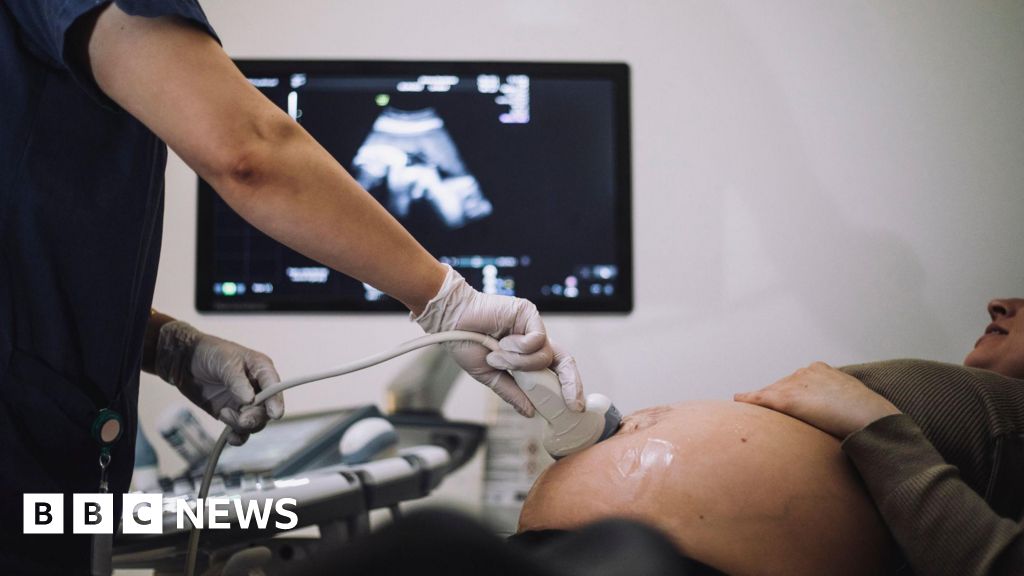 Warning over high street baby scans giving ‘dangerous advice’