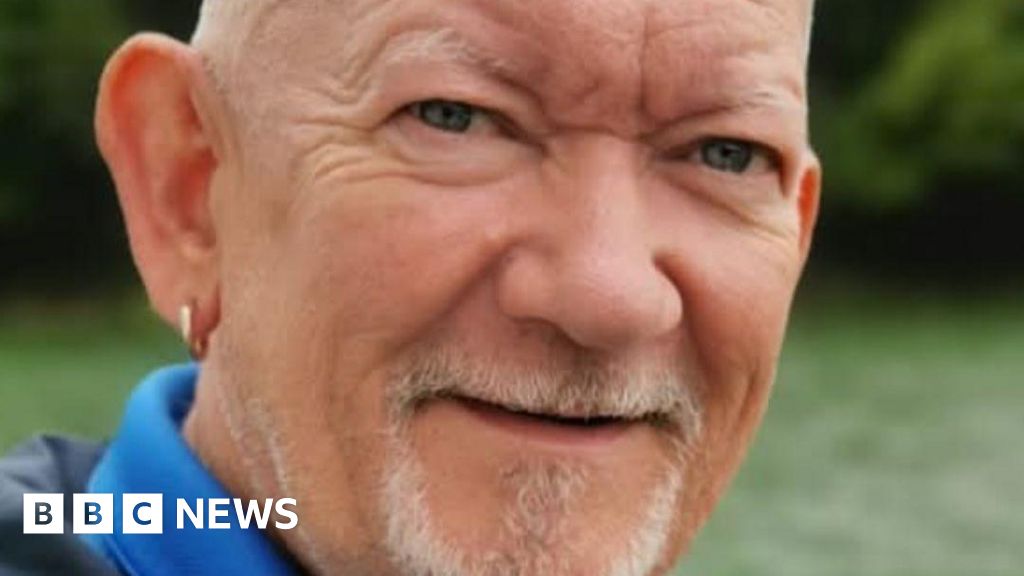 Countess of Chester Hospital failed to tell man he was dying